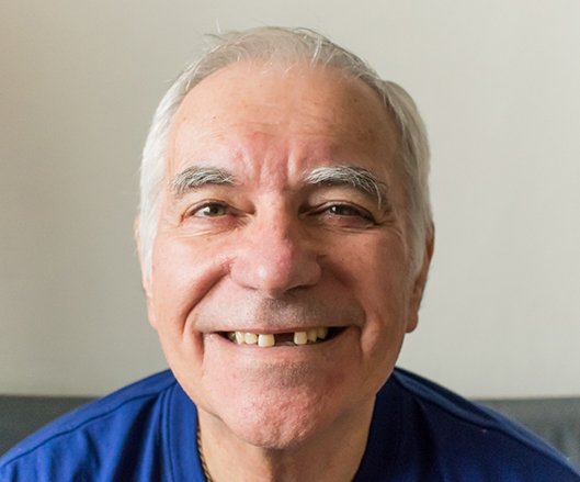 A man with a missing tooth