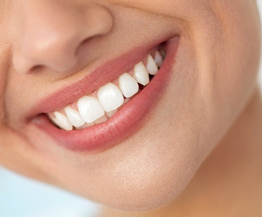 Woman's smile after teeth whitening