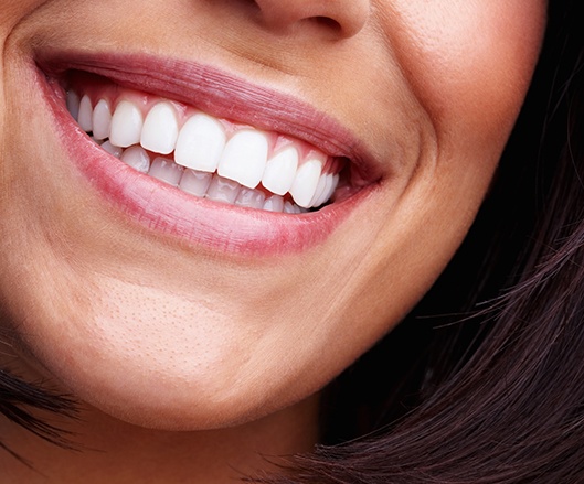 Woman sharing smile after gum recontouring treatment