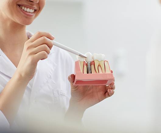 Smiling dental team member pointing to dental implant model