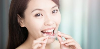 Woman placing Invisalign tray