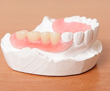Model smile with partial denture in place