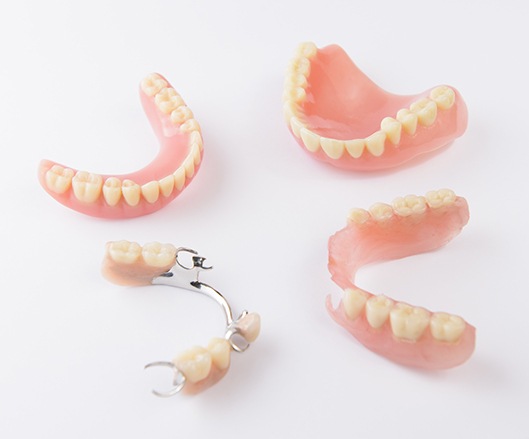 Four types of dentures