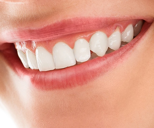 An up-close look at a person’s teeth and gums that are symmetrical 