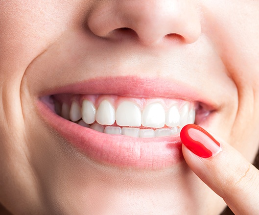 Woman pointing to smile after scaling and root planing treatment