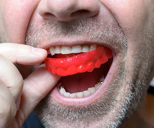 Man placing athletic mouthguard