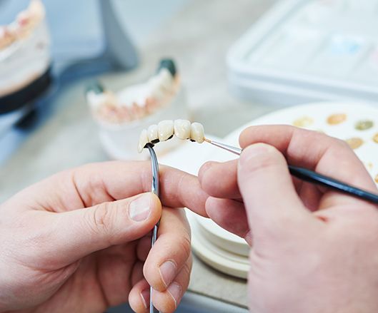 Dental lab technician grafting prosthetic teeth for prosthodontic treatment