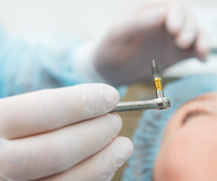 Dental implants surgery is the second step in the dental implant process